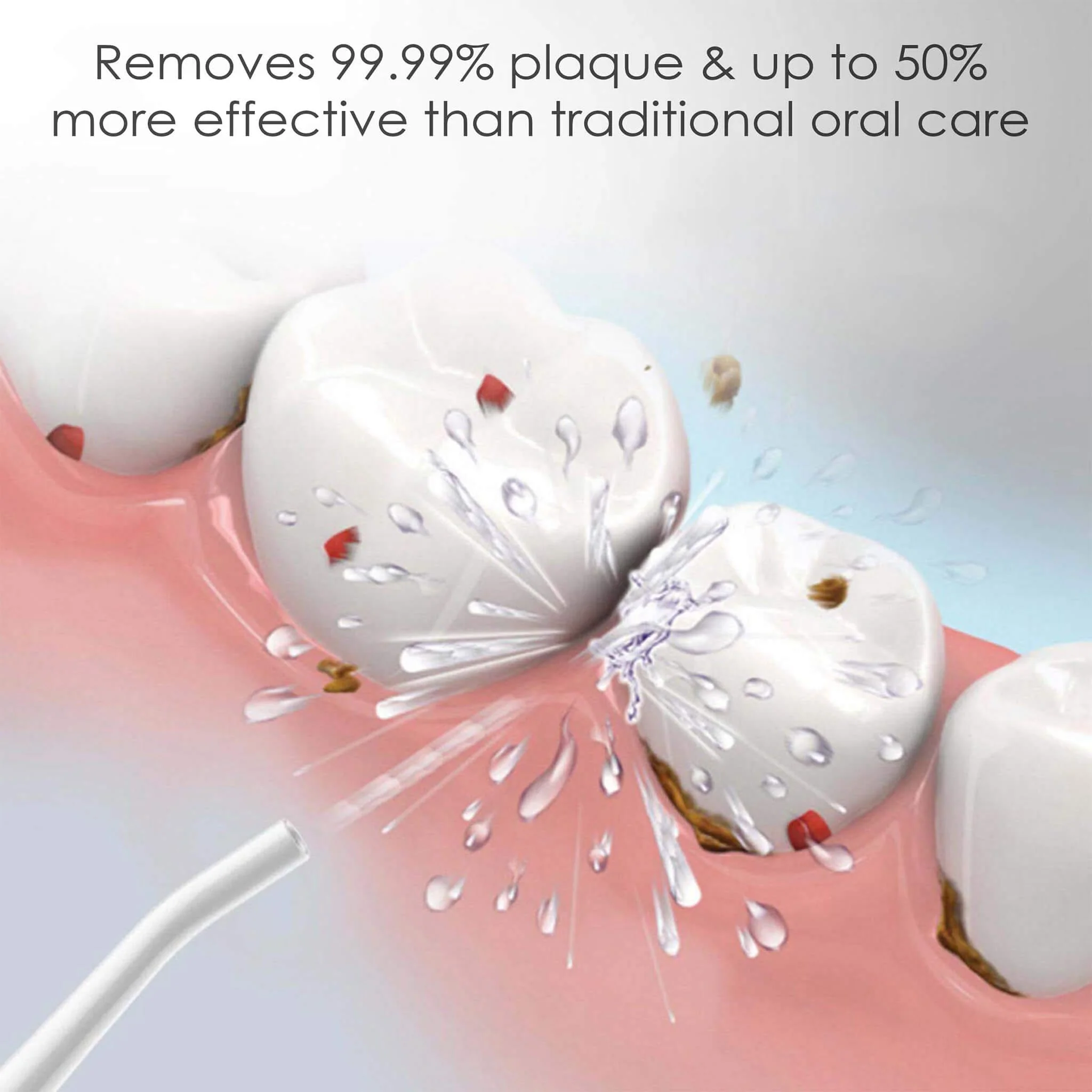 Oral Irrigator Nozzle Tip - Image 3